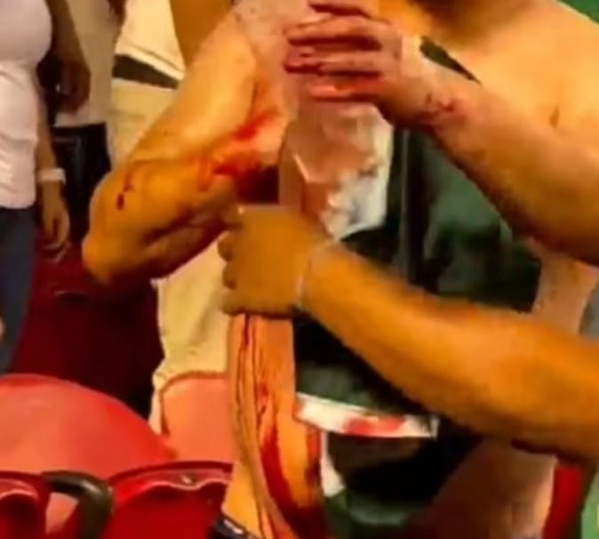A Mexico fan pictured holding his jersey over a stab wound after being attacked during a game in Santa Clara during the 2023 CONCACAF Gold Cup